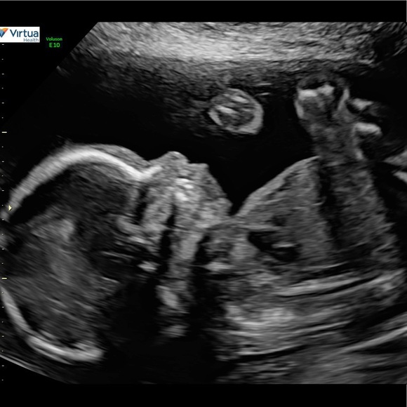 Meet your Posher, Lauren - Picture 9 of 11